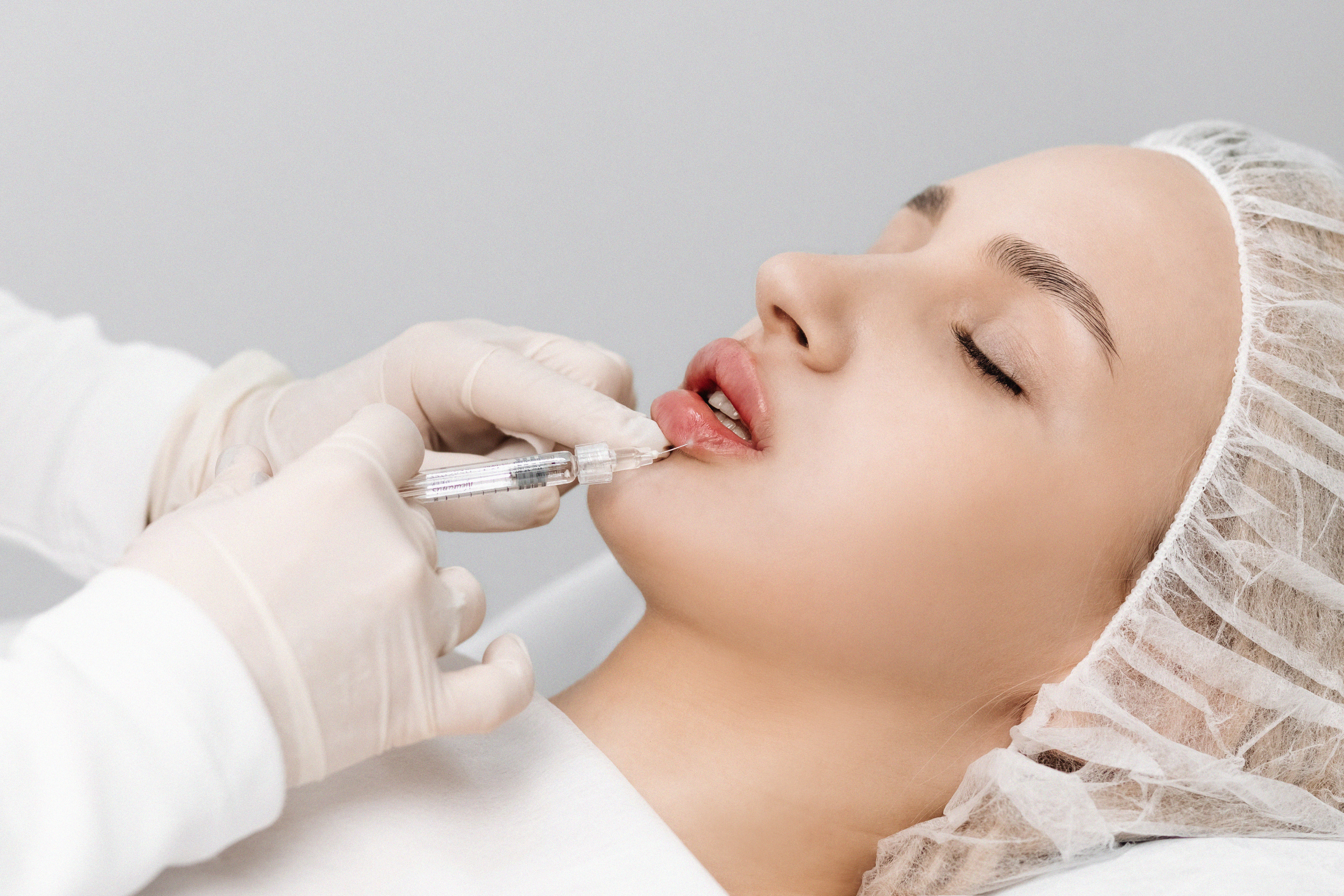 Preenchimento labial harmônico